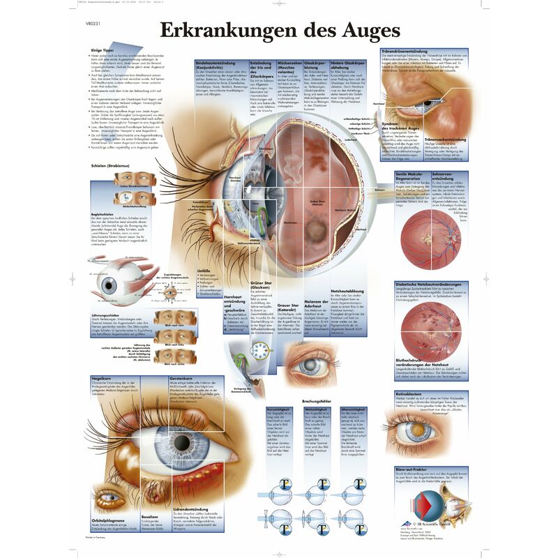 Image of 3b Scientific - kawe lavagna patologie del occhio, 1
