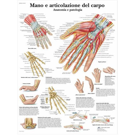 3B Scientific VR4171L Mano e Articolazione del Carpo