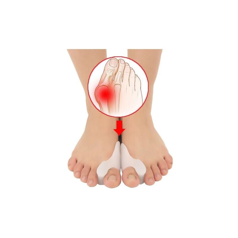 Correcteur d'hallux valgus [6x] silicone amélioré, taille unique - séparateur d'orteils, redresseur, entretoise d'orthèse du pied pour la protection