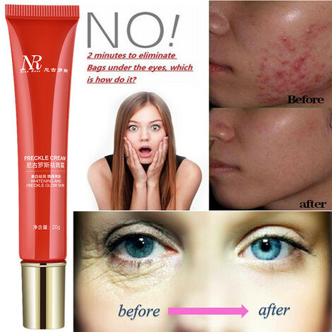Crème glacée circulaire Pour crème Anti-rides, extrait Pour l&39élimination des marques d&39acné, traitement du visage, rouleau de soins Pour la peau, 20g,CHINA,Red