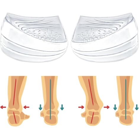 CSPARKV 1 Pair Adjustable Heel Insoles for Supination, Pronation Correction, Orthopedic for Curved Legs, Foot Alignment (Transparent), Small Size