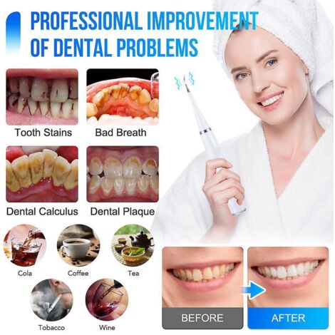 dtartreur Dentaire  Ultrasons Pour Les Dents Tartre Tache De Dents Calcul Dentaire Remover Lectrique Sonic Dents Plaque Cleaner Dental Stone Remov