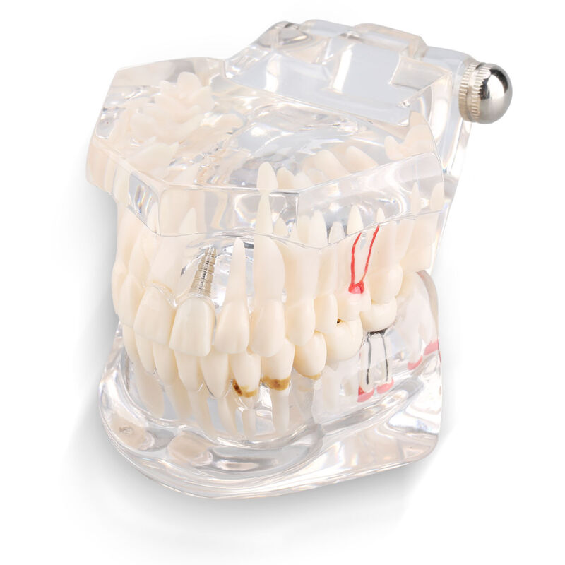 Tude d'enseignement de la maladie dentaire Adulte Typodont Démonstration de dents Modèle Nouveau