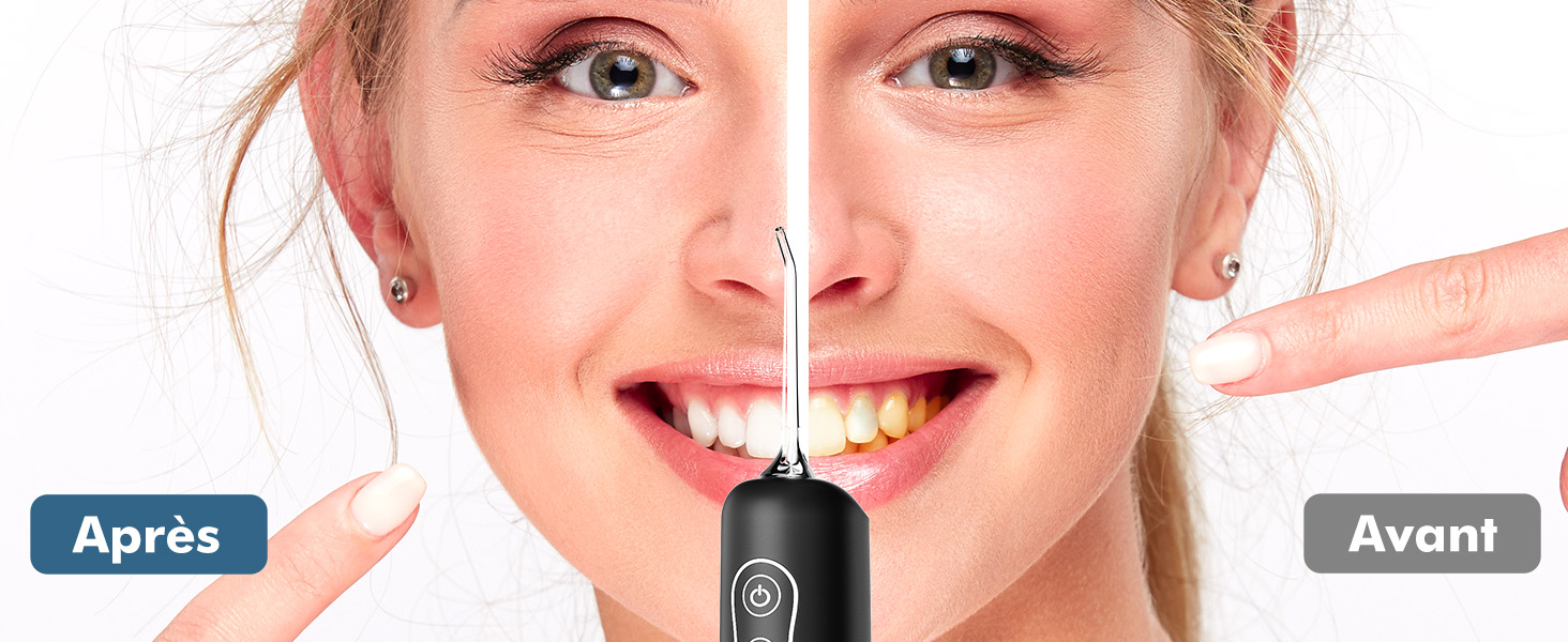 Jet Dentaire Hydropulseur