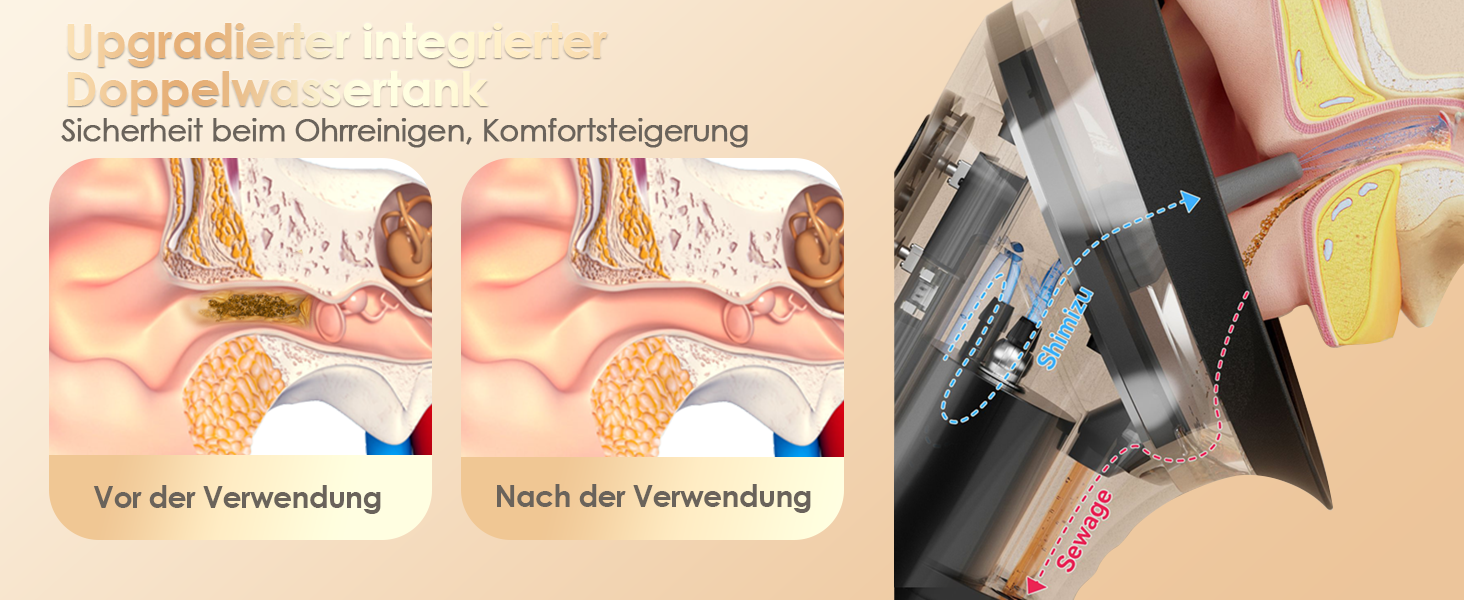 aplus content image