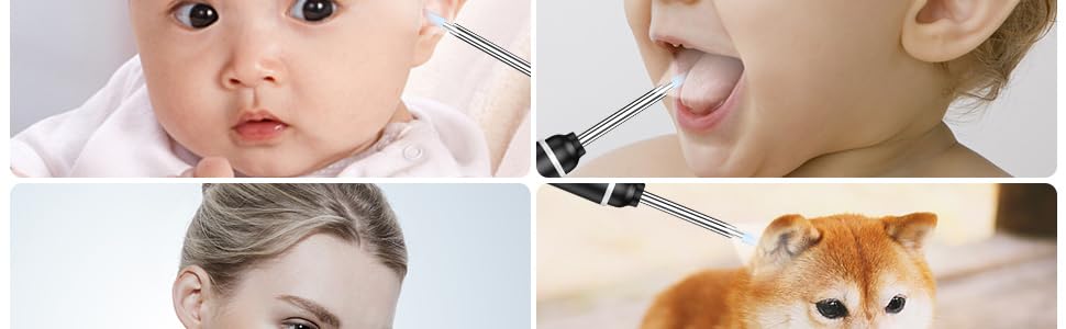 wide use of earwax removal kit