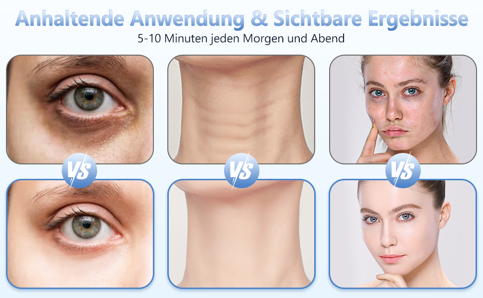 Vergleich der Hautpflegeergebnisse vor und nach der Anwendung, wobei Verbesserungen der Augenpartie, des Halses und des gesamten Gesichtsbildes nach der Anwendung des Produkts festgestellt wurden.