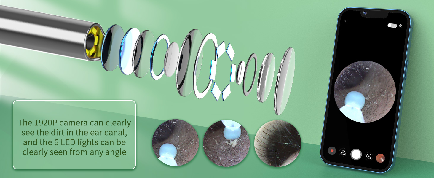 ear wax removal