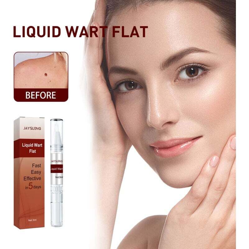 Image of Flüssiger Stift zur Warzenentfernung. Entfernung von Muttermalen bei Fadenwarzen. 3 ml