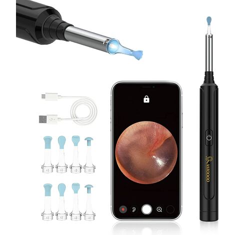 Earwax Removal Using a Digital Otoscope at Home 