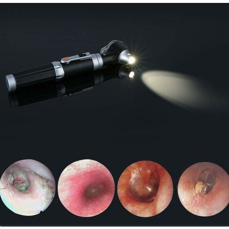 Mini Otoscope Oreille,Grossissement Diagnostic Inspection Scope de  l'oreille avec LED Illumination Directe Oreille Outil Sain pour Médecins  Infirmière Enfants