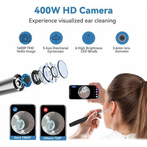 Otoscope Oreille Endoscope Caméra Oreille,dolaso 1600P HD 3.6mm Kit de  Nettoyage d'Oreille avec