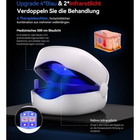 Appareil laser contre les champignons des ongles - Mise à niveau 4 x bleu et 2 x lumière infrarouge - Doublez le traitement - Traitement industriel n° 1 - Certifié SGS - Traitement contre les