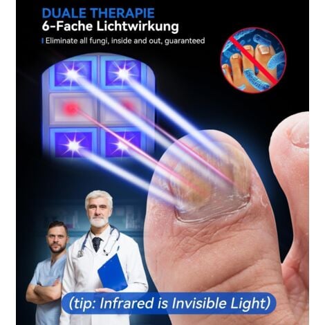 Appareil laser contre les champignons des ongles - Mise à niveau 4 x bleu et 2 x lumière infrarouge - Doublez le traitement - Traitement industriel n° 1 - Certifié SGS - Traitement contre les