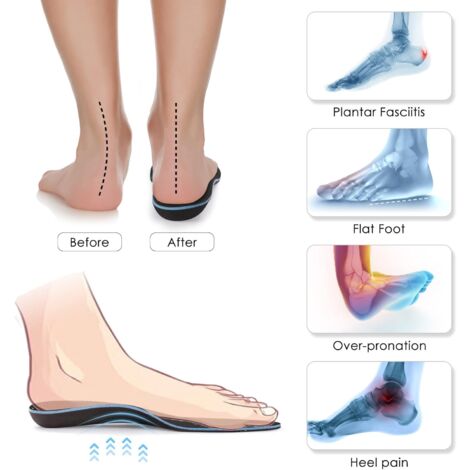Orteil Chaussures De SÃ©curitÃ© Mal Aux Pieds Voûte Plantaire Mal