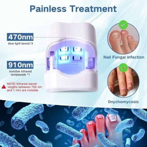 Appareil Traitement Laser Mycose Ongles, Portable Dispositif des Champignons des Ongles, Dispositif de Traitement Laser pour Mycose Ongles des Pieds Nettoyage et Réparation Ongles Traitement