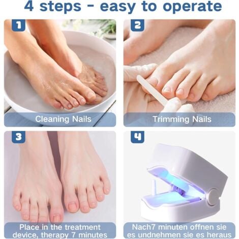 Appareil Traitement Laser Mycose Ongles, Portable Dispositif des Champignons des Ongles, Dispositif de Traitement Laser pour Mycose Ongles des Pieds Nettoyage et Réparation Ongles Traitement