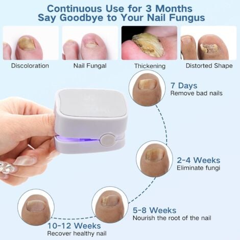 Appareil Traitement Laser Mycose Ongles, Portable Dispositif des Champignons des Ongles, Dispositif de Traitement Laser pour Mycose Ongles des Pieds Nettoyage et Réparation Ongles Traitement