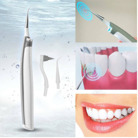 Trade Shop - Limpieza De Dientes Ultrasónicos Con Batería Led Manchas De Eliminación De Tártaros -