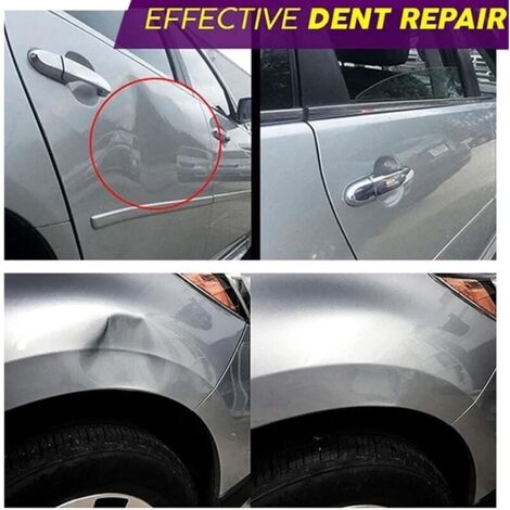 2 Pièces Ventouse Débosselage Voiture - Réparation Bosses Sans Endommager La Peinture, Réutilisable