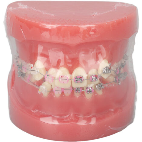 Modèle Dentaire Démontable pour Enseignement et Recherche en Orthodontie (1/5)