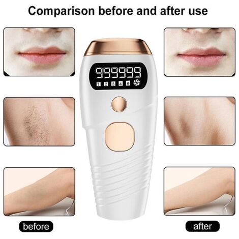 appareil D'pilation Au Laser (blanc), Appareil D'pilation Permanente Pour Peaux Sensibles, Rajeunisseur De Peau (1/3)
