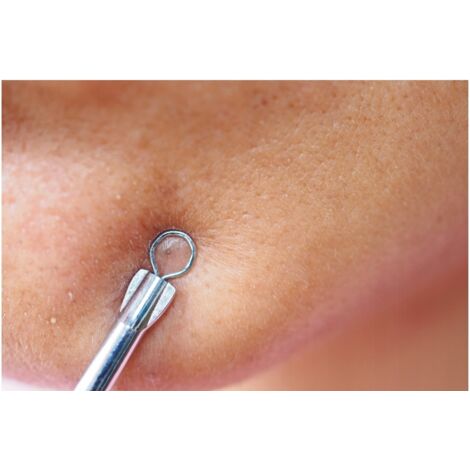 Cuillères pour enlever les points noirs, boutons, comédons, SOULIMA SET 7 pièces