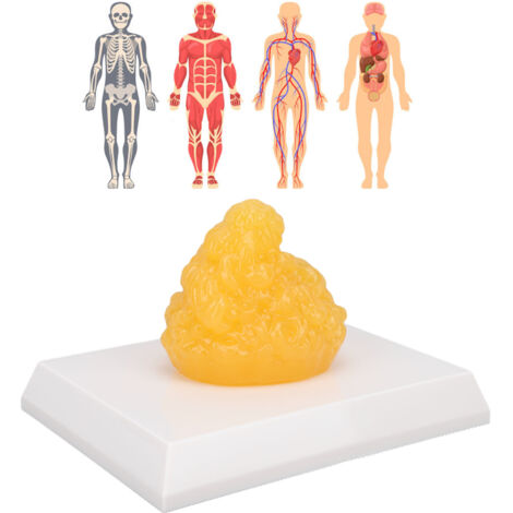 Modèle de démonstration de tissu adipeux humain (réplique) : motivation pour la perte de poids (cours d’anatomie pour nutritionnistes). (1/3)