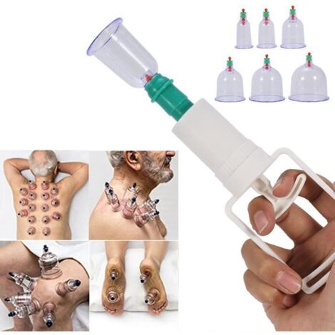 Kit de thérapie par ventouses - YES - 12 Cupping Ventouse - Pistolet d\'aspiration - Anti Fatigue - Mixte