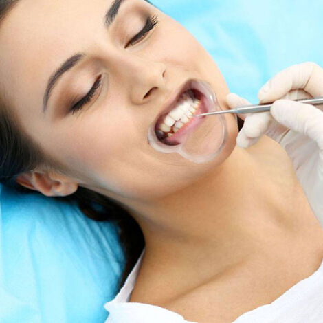 Écarteur de Bouche Dentaire 15 Pièces pour Blanchiment, 3 Tailles en Forme C, Retracteur de Lèvres et Joues (1/4)