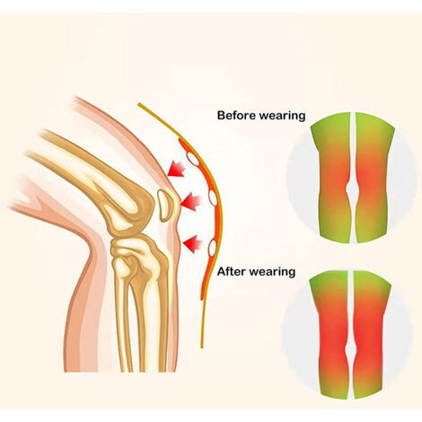 1 Paire de Genouillères Chauffantes à l'Armoise pour Course à Pied, Protection Articulaire contre les Blessures du Genou et l'Arthrite (1/5)