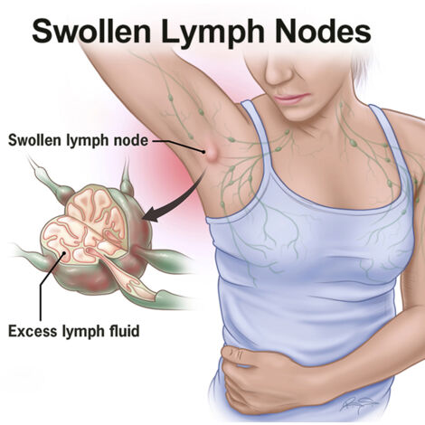 Patchs Détox Plantes pour Cou et Décolleté - Soin Lymphatique Anti-Gonflement (1/5)