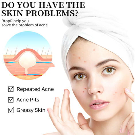 Crème Anti-Boutons et Points Noirs, Atténue Cicatrices et Réduit les Pores pour un Teint Unifié (1/5)