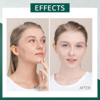 Masque Argile Purifiant à la Centella Asiatica pour Points Noirs et Hydratation Peau