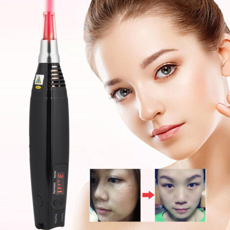 Stylo Laser Rouge Picoseconde pour Enlever Tatouages et Taches, Anti-Mélanine, Alimentation UE (1/5)