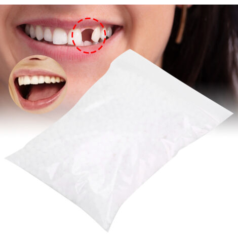 Perles de réparation dentaire temporaire pour dents manquantes ou cassées, matériau de remplissage dentaire 50g