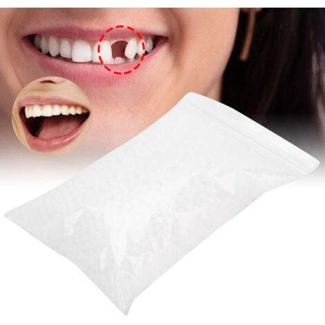 Perles de réparation dentaire temporaire pour dents manquantes ou cassées, matériau de comblement dentaire 100g