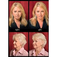 Bandes de Lissage Facial Anti-Rides et Anti-Cernes - Serre-Tête Invisible Lifting