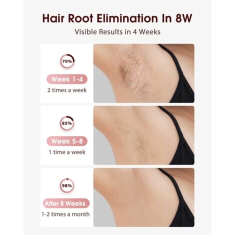 Épilation laser IPL avec système de refroidissement par la glace pour des résultats indolores et durables. - AquaForge (1/2)