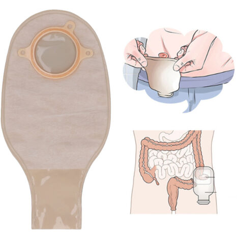 [Kolostomiebeutel] Medizinischer Beutel [ABS] Tragbarer, auslaufsicherer Stomabeutel aus Vliesstoff für Ileostomie mit kontinuierlicher Drainage