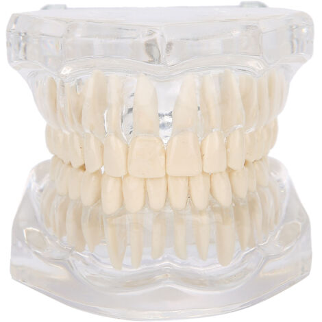 Modèle de Dents Acrylique Transparent pour Démonstration Dentaire et Enseignement