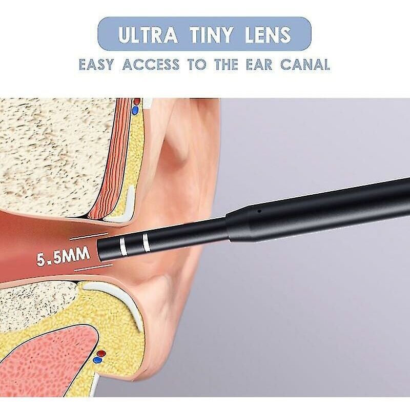 SNQ - Otoscope médical dans les oreilles, nettoyeur d'oreille, Endoscope, appareil photo, cire de nettoyage des oreilles, Android Pc, Type c