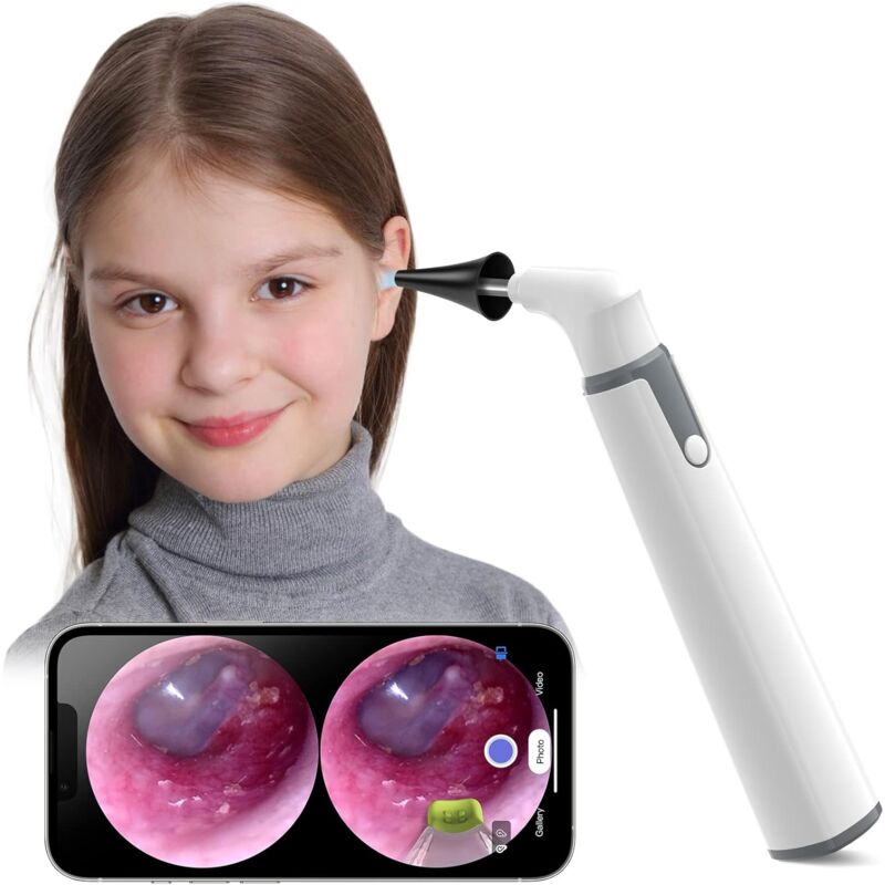 Otoscope, otoscope hd sans fil ultra-fin avec lumière, nettoyeur d'oreilles avec contrôle de la température et gyroscope, endoscope auriculaire,