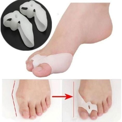 Séparateur Correction Lisseur Orteil Hallux Valgus Silicone - 2x - Réduire Friction (1/2)