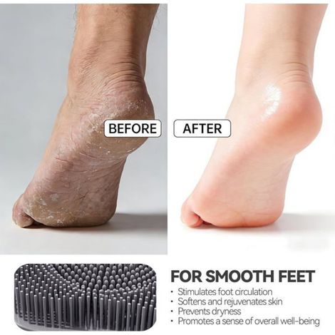 Tapis Brosse Pied Douche Exfoliant et Massage, Modèle Ventouses Murales, Silicone Antidérapant Gris (1/5)