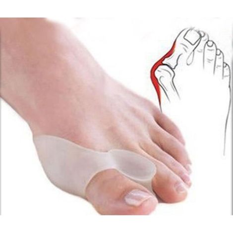 Une Paire de Orthese Redressement Protecteur Valgus Gros Orteil Soulagement (1/2)