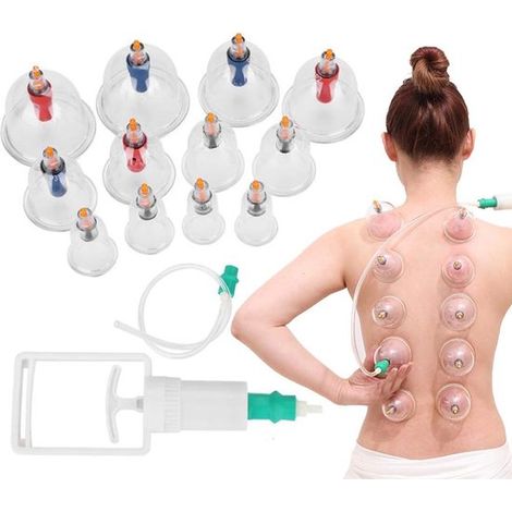 Kit de ventouses - Kit de ventouses avec pompe - Massage par ventouses - Massage par aspiration - Massage par ventouses - Relaxation et bien-être (1/5)