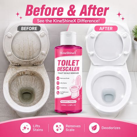 KineShineX Badezimmer-WC-Entkalker, WC-Reinigungsflüssigkeit entfernt Kalkablagerungen, Urinflecken, gelbe Flecken und Gerüche. (1/4)