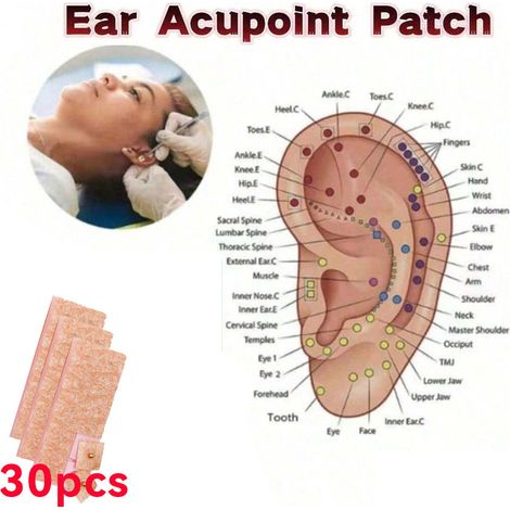 Patchs auriculaires magnétiques, boucles d'oreilles dorées, autocollants de kit d'acupuncture avec graines auriculaires dorées, patchs auriculaires, patchs d'aiguilles (1/4)