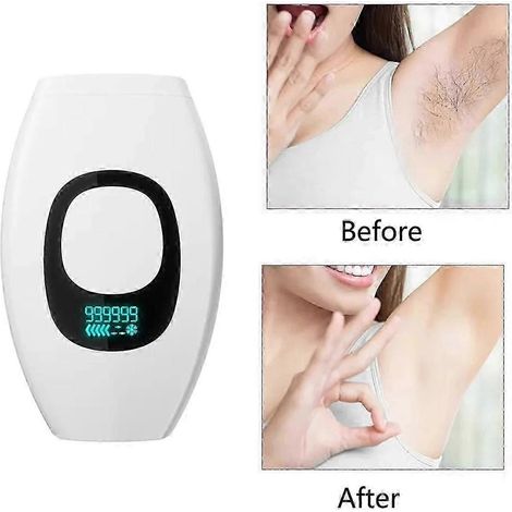 Épilateur laser IPL pour le corps des femmes, 999 999 flashs, épilation définitive et indolore, prise européenne A (1/5)